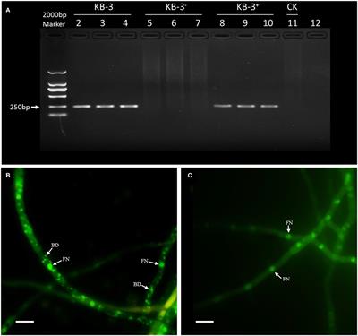 Plant Growth-Promoting Ability of Mycorrhizal Fusarium Strain KB-3 Enhanced by Its IAA Producing Endohyphal Bacterium, Klebsiella aerogenes